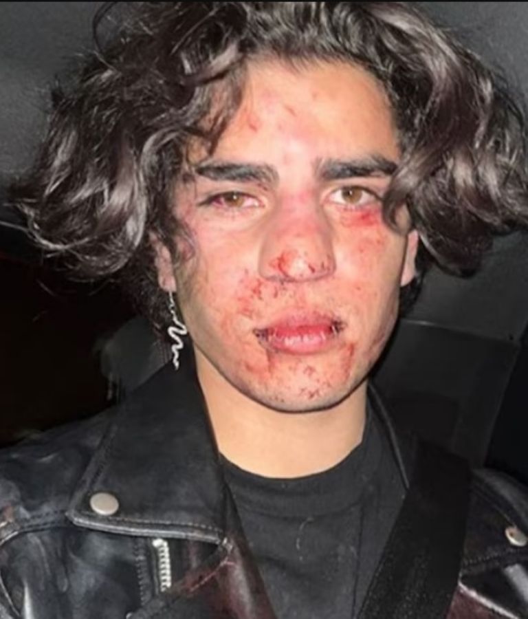Aarón Mercury tras la golpiza 