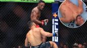 Foto ilustrativa de la nota titulada VIDEO: El impresionante y brutal KO que recibió una estrella de MMA durante su debut en UFC