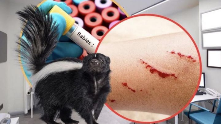 Se reporta en México muerte por rabia humana: Casos, síntomas y maneras de adquirirla