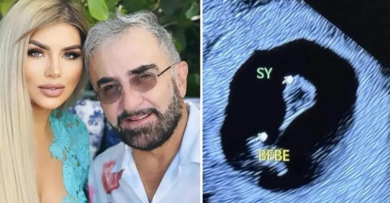 Fotografía de un ultrasonido difundido en redes