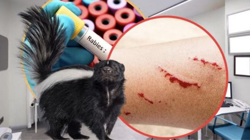 Se reporta en México muerte por rabia humana: Casos, síntomas y maneras de adquirirla