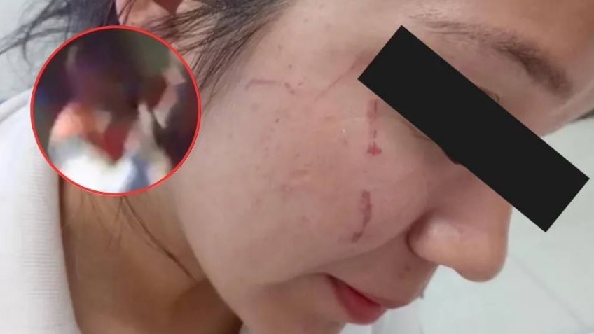 Tras intentar escapar del alcoholímetro, mujeres agreden a oficial de Tránsito en Torreón