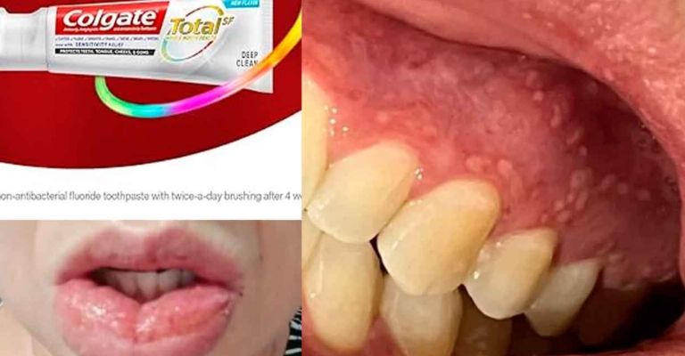 La empresa ha registrado solo un pequeño porcentaje de casos