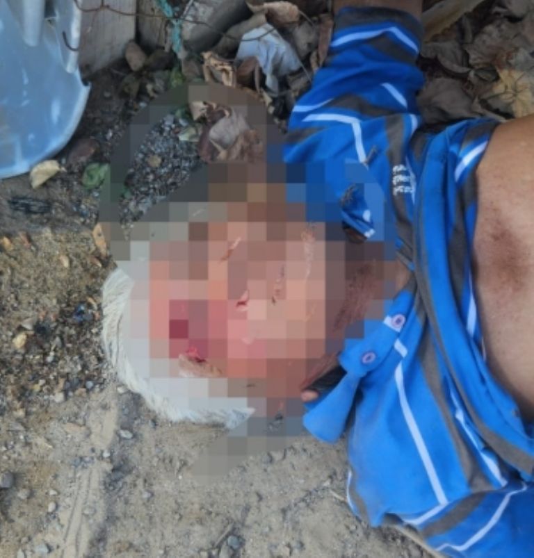 José resultó con varias contusiones y laceraciones 