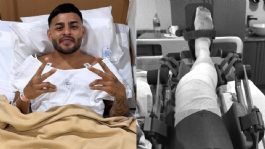 Foto que representa a Alexis Vega fue operado por un problema articular; se perderá varios partidos con el Toluca y México