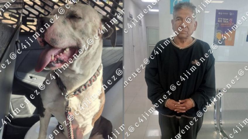 Perro pitbull se suelta y se lanza contra un hombre; así ocurrió el BRUTAL ATAQUE en GAM, CDMX