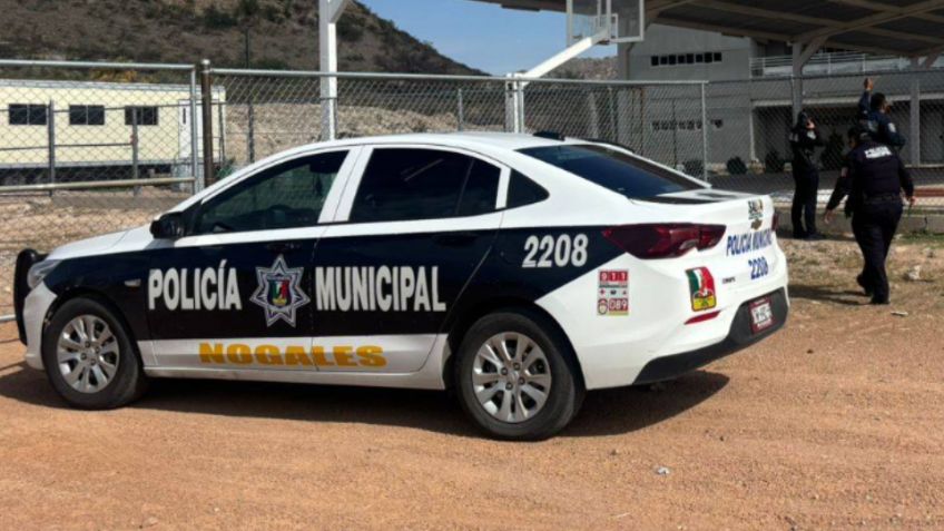 Nogales registra dos ataques de perros: Mujer sufre fisura en el brazo y adulto mayor es mordido