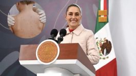 Foto que representa a Sarampión en México: Sheinbaum confirma brotes en Jalisco, CDMX y Edomex; hay vacunas, dice