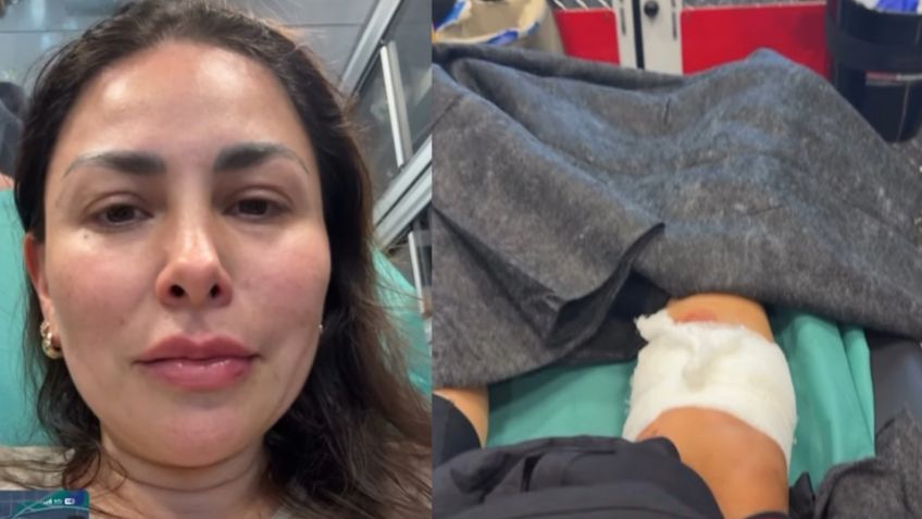 Pensó que perdería la pierna: Actriz de Televisa revela que sacrificaron a perro que la atacó en EU