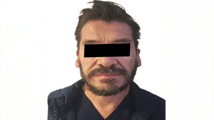 Liposucción terminó en tragedia: Arrestan a cirujano plástico por muerte de paciente en Edomex