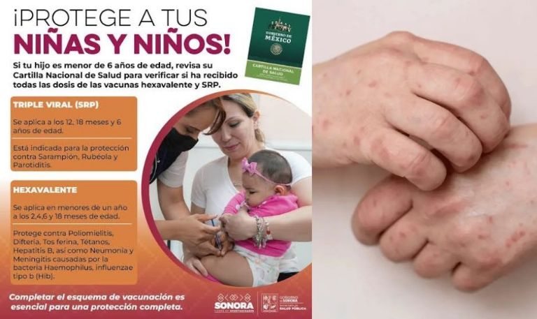 Sonora intensifica medidas de control contra el sarampión y refuerza bloqueo vacunal