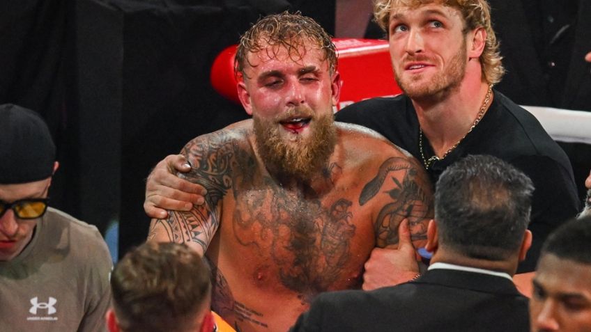 Jake Paul se recupera de una segunda operación mandibular; regresará al boxeo hasta finales del 2026